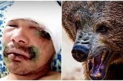 Kinh hãi giây phút người đàn ông bị gấu hoang ngoạm đầu, cấu xé
