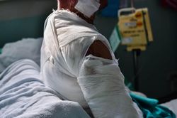 'Dị nhân' môi mọc trên ngực và đây là sự thật xót xa