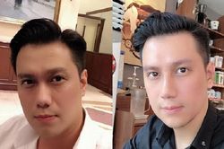 Việt Anh bị chê xấu sau phẫu thuật thẩm mỹ, Quế Vân lên tiếng bênh vực