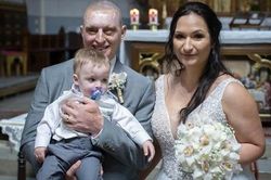 Sau 20 cuộc phẫu thuật, chàng trai bị người yêu cũ tạt axit tìm được tình yêu bên nữ y tá