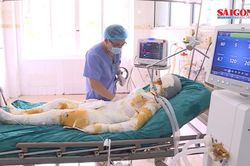 Vì ghen tuông, thanh niên tẩm xăng thiêu sống cả nhà người tình