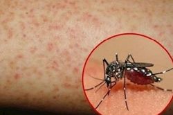 Phòng ngừa bệnh sốt xuất huyết trong mùa dịch cao điểm