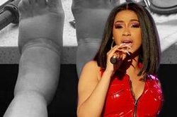 Người hâm mộ lo lắng khi Cardi B cho biết đôi chân của cô đang phải chịu di chứng nặng nề từ việc phẫu thuật thẩm mỹ