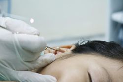 Hạt đồ chơi 'đi lạc' vào tai bé gái 8 tuổi ở Quảng Ninh
