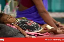 Chế độ ăn 'kỳ diệu' cho hàng triệu trẻ em suy dinh dưỡng
