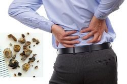 Có thể hỏng thận vĩnh viễn vì lý do không thể ngờ này