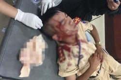 Vợ vi phạm giao thông vì chở 3 không đội mũ bảo hiểm, chồng cầm đá tấn công đại úy CSGT nhập viện