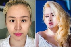 Trầm cảm vì mũi biến dạng đau đớn sau phẫu thuật, 'bà Tưng' Huyền Anh sửa mũi lần 4, kết quả thật đáng ngạc nhiên