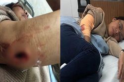 Nhóm côn đồ bịt mặt chém trọng thương người nhà 'con nợ' ở Lâm Đồng