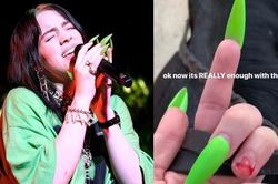 Ngôi sao Billie Eilish chịu đau đớn vì thú chơi móng tay dài