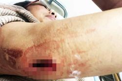 Nữ chủ quán cà phê bị nhóm đòi nợ thuê chém gục