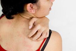 Những dấu hiệu tố cáo thận của bạn đang gặp vấn đề