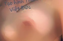 Sau nâng ngực, người mẹ trẻ hú hồn vì ngực trái bất ngờ to như trái bóng bay