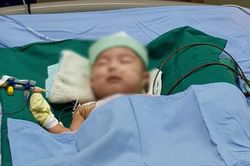 Vá lỗ thông liên thất cực lớn, cứu sống bé trai 5 tháng tuổi