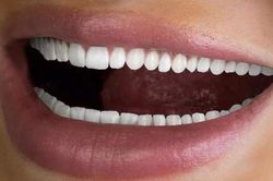 Quảng cáo làm trắng hàm răng đến… 60 chiếc, công ty nha khoa ngập trong bình luận chỉ trích