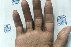 Hy hữu: Nhiễm độc thạch tín vì thói quen xông nhà mới gần 10 năm