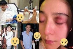 Tai nạn nguy hiểm trên phim trường của sao Hoa Ngữ: Phạm Băng Băng suýt mù mắt, Phùng Thiệu Phong bị ngựa hất văng