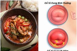 5 thực phẩm 'nuôi' khối u xơ tử cung lớn mỗi ngày, cần tránh xa