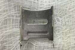 Bé 2 tuổi ở Hà Nội phải vào viện cấp cứu vì nuốt khay sim điện thoại