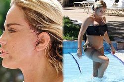 Katie Price mang mặt sẹo, bó căng ngực đi bơi hậu 'đại tu' ngoại hình
