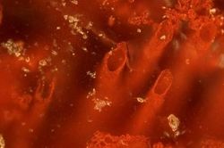 Vi sinh vật tìm thấy ở Kamchatka giúp điều trị khối u