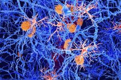 Phát hiện sự liên quan giữa tế bào miễn dịch ở não và bệnh Alzheimer