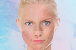 Phải làm thế nào khi làn da bị dị ứng mỹ phẩm?