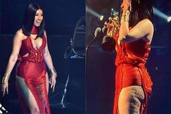 Đôi chân Cardi B bị biến dạng lồi lõm do phẫu thuật thẩm mỹ
