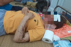 Vụ tạt axít vào phụ bếp ở Hòa Bình: Nạn nhân từng bị đe dọa giết