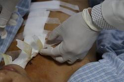 Nam thanh niên bị đâm đứt lìa động mạch cổ