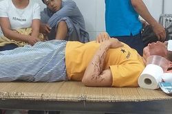 Giây phút khiếp đảm của nữ phụ bếp bị kẻ lạ mặt tạt a-xít tại Hòa Bình