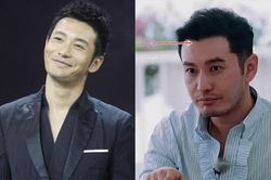 Huỳnh Hiểu Minh bị hói, phải cậy nhờ đến công nghệ cấy tóc?