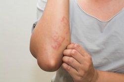 Những dấu hiệu 'vặt vãnh' này cảnh báo ung thư gan đang 'trú' trong người bạn