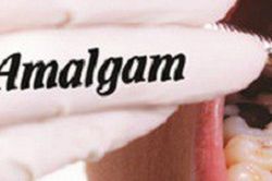 Amalgam – loại chất công ty Rạng Đông sử dụng thay thế thủy ngân thực chất là gì và có nguy hại không?