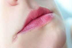 Làm gì khi bị giời leo?