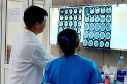 Nam thanh niên bị xuất huyết, phù não do ngộ độc ma túy đá