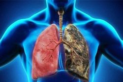 Ung thư và những hiểu biết sai lầm mà nhiều người đang mắc phải