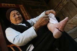 Người phụ nữ 'gót sen' bật khóc vì nhớ cảnh đau đớn khi bó chân