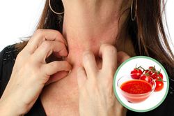 Cà chua tưởng tốt nhưng lại vô cùng độc hại với những người này