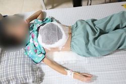 Nghe lời thầy lang chữa ung thư vú, nữ bệnh nhân phải trả giá