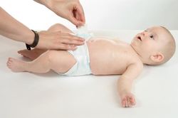 Dùng tã sai cách có thể ảnh hưởng tới sự vận động của trẻ