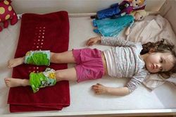 Mẹ buộc khăn và bắp chân con hạ sốt, ai cũng tưởng dở hơi nhưng hiệu quả lại vô cùng bất ngờ