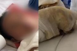 Vô tình trượt chân vào bể tro lớn khi hóa vàng, cô gái bị bỏng nặng