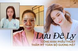 Công khai phẫu thuật thẩm mỹ toàn bộ gương mặt, Lưu Đê Ly khiến ai cũng choáng váng