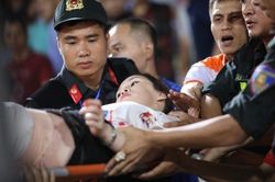 Khán giả nữ bị bỏng pháo sáng được chi trả toàn bộ viện phí