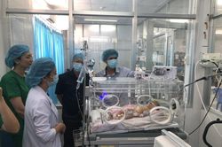 Cứu sống bé gái 9 ngày tuổi có tạng từ ổ bụng chui lên lồng ngực