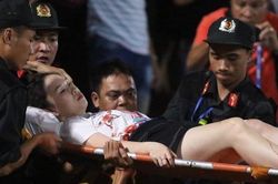 Hà Nội FC lo toàn bộ chi phí phẫu thuật cho cổ động viên nữ bị trúng pháo sáng