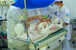 Bé gái có nội tạng trong lồng ngực, tim nằm bên phải