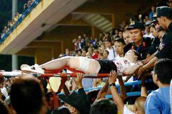 Pháo sáng ở V-League: Không chỉ là sự cố...