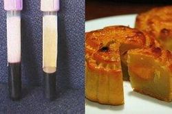 Tiếc rẻ bánh trung thu, người đàn ông ăn 4 chiếc mỗi ngày khiến máu có màu trắng đục